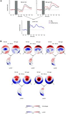 Single-Pulse TMS to the Temporo-Occipital and Dorsolateral Prefrontal Cortex Evokes Lateralized Long Latency EEG Responses at the Stimulation Site